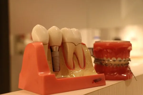 美齒意識抬頭 牙科數位化因應趨勢