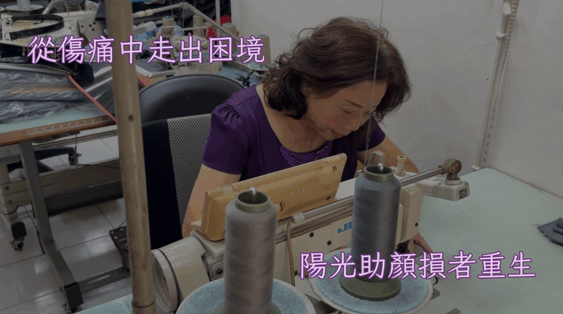 從傷痛中走出困境 陽光助顏損者重生