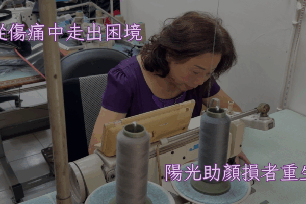 從傷痛中走出困境 陽光助顏損者重生